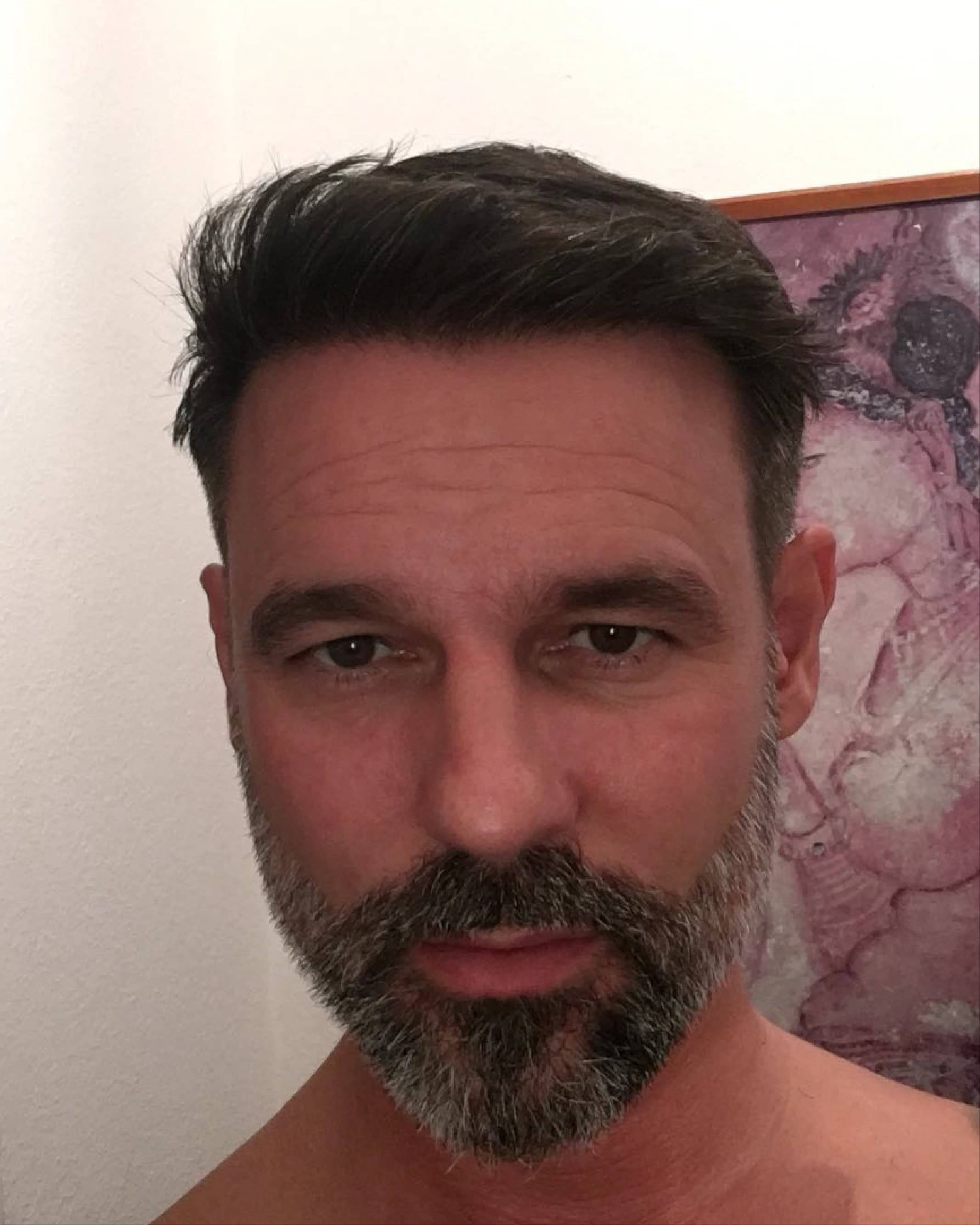 After treatment