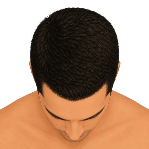 Stage 1 - top view