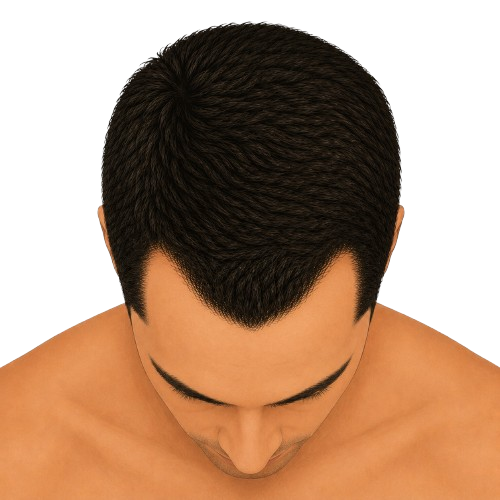 Stage 2 - top view