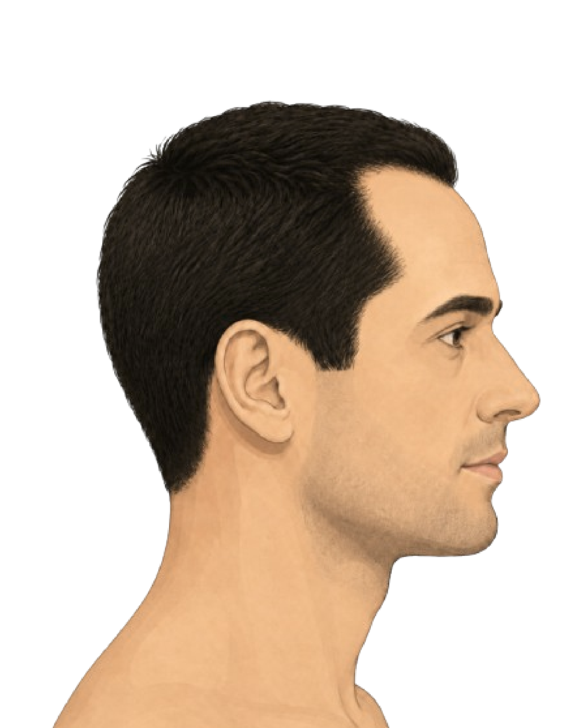 Stage 3
