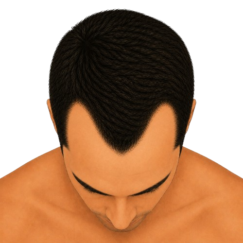 Stage 3 - top view