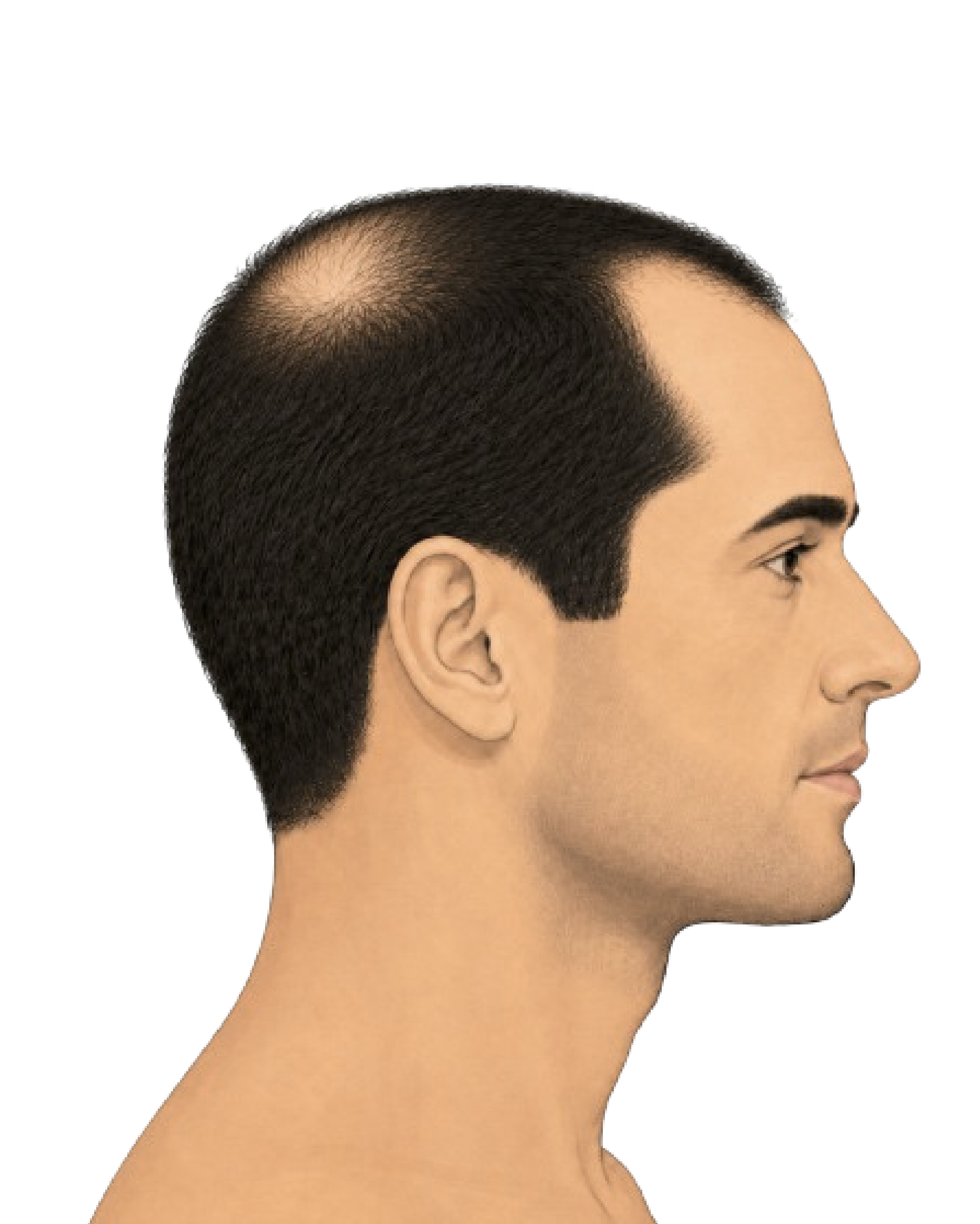 Stage 3 Vertex