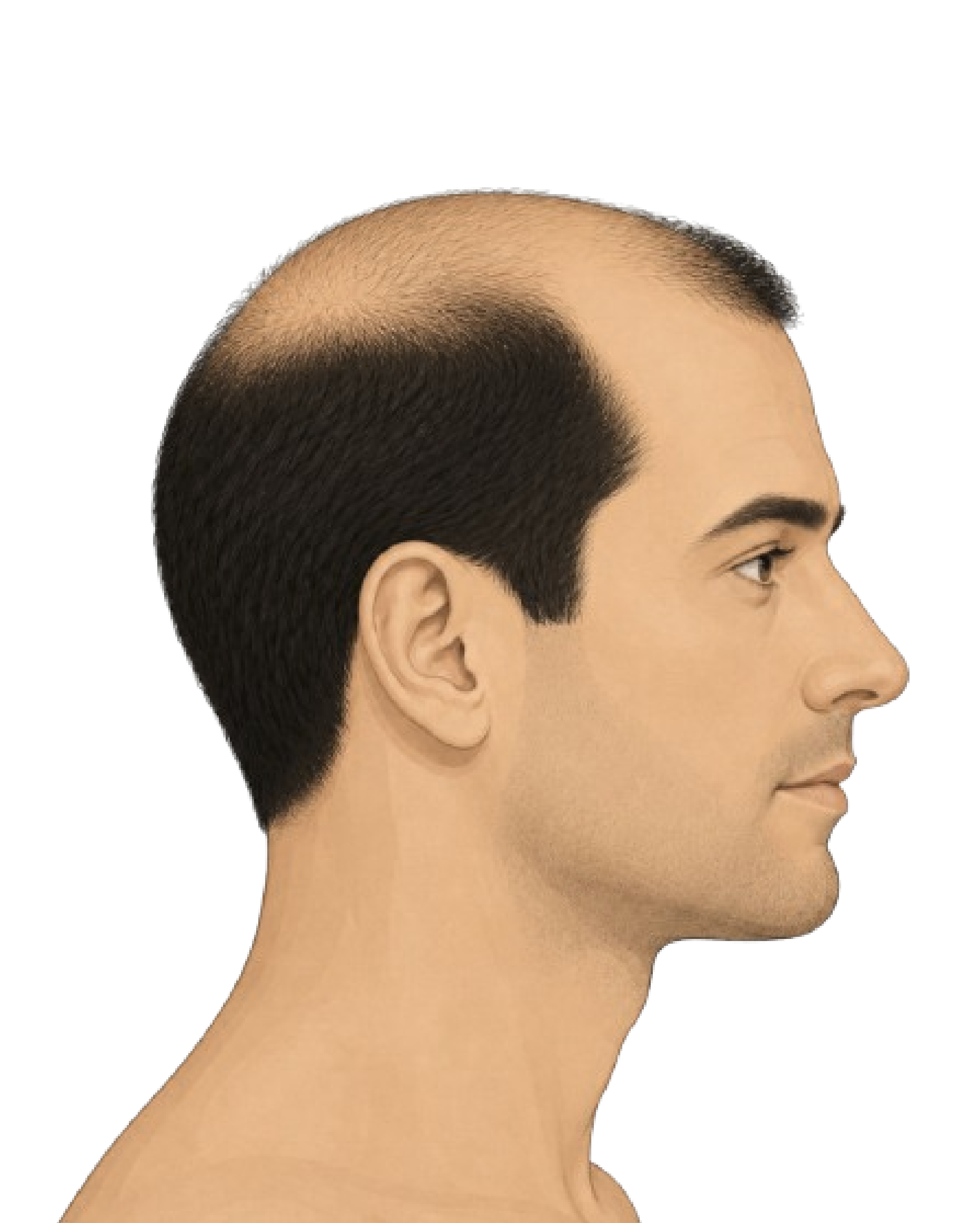Stage 5
