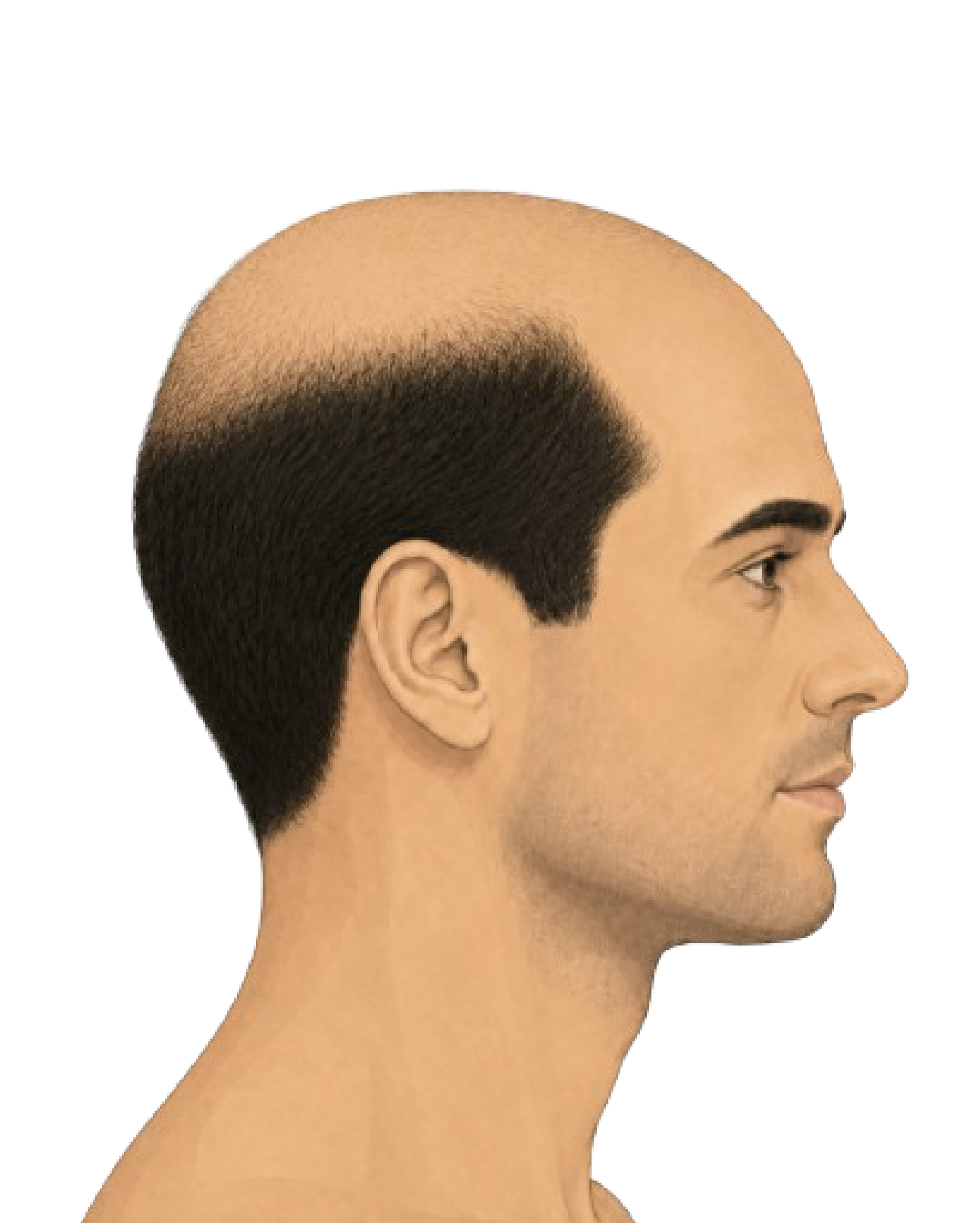 Stage 6