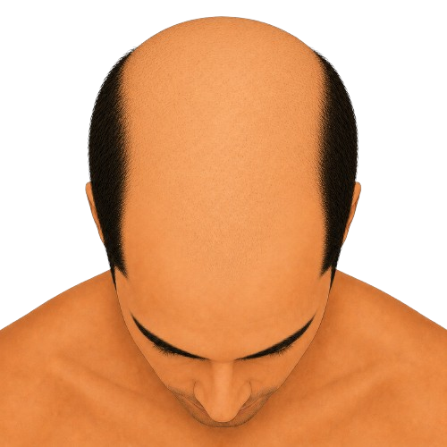 Stage 6 - top view
