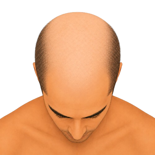 Stage 7 - top view